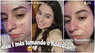 MEU PRIMEIRO MÊS TOMANDO O ROACUTAN!✨ |diário do Roacutan +minha história com a acne