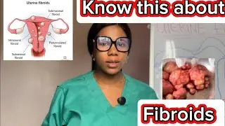 Everything You Need to Know About Fibroids | Complete Guide