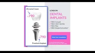 Dental Implants London &mdash; Premium Implant &pound;790 + FREE CBCT & Consultation