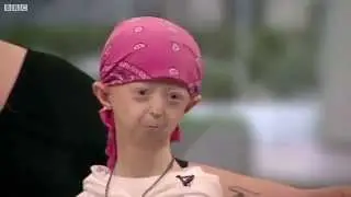 14-Year-Old Girl Has The Body Of A 100-Year-Old!