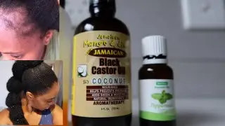 CASTOR OIL & PEPPERMINT OIL  FOR HAIR GROWTH | GROW YOUR THINNING EDGES FAST | NAMIBIAN YOUTUBER