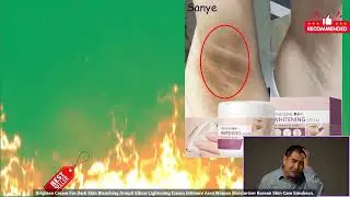 3256806704083399 Brighten Cream For Dark Skin Bleaching Armpit Elbow Lightening Cream I