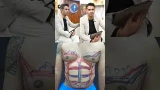 6 Pack Surgery Pakistan - Belly fat removal - Chest fat removal - Liposuction Karachi