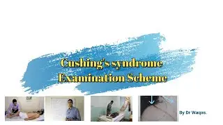 Cushing's Syndrome. (Patient Examination)