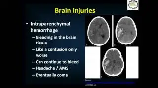 Head and Spinal Injuries