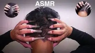 ASMR Fast and Aggressive Scalp Scratch for my itchy scalp ( No Talking )