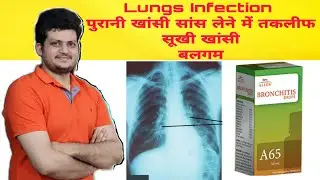 Homeopathic Medicine for Lungs Infection | Allen A65 |