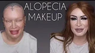 ALOPECIA MAKEUP | MicheMoffatt