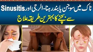 Band Naak Kholne Ka Tarika - Band Naak Ka ilaj - Sinus Treatment Home Tips - Naak Ki Allergy Ka ilaj