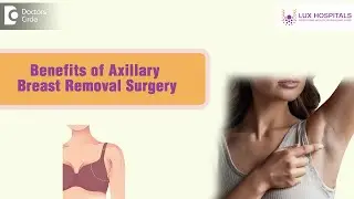 Breast size increase | Extra Breast Lump in Underarm | Axillary #breast Removal -Dr. Chandana Guduru