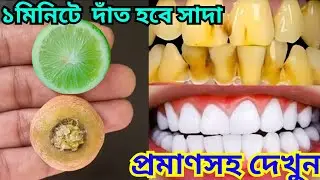 এক মিনিটে দাঁত হবে দুধের মতো সাদা 😱 | Teeth Whitening in 1 Minute | Proof | Mariam's Ammu