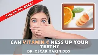 CAN VITAMIN C MESS UP YOUR TEETH?