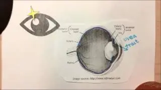 GLSE Talks: Efficacy of TNF-alpha Inhibitors for Uveitis in Anklosing Spondylitis Patients