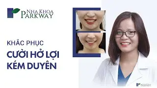 CÓ NÊN CHỮA CƯỜI HỞ LỢI HAY KHÔNG? CƯỜI HỞ LỢI CHỮA TRỊ NHƯ NÀO?