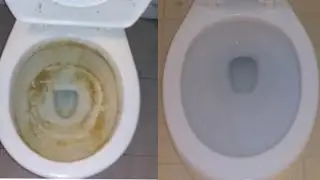 🛑COMO LIMPIAR EL INODORO. RETRETE WC QUITAR EL SARRO Limpieza Extrema /Limpieza de casas VIRAL