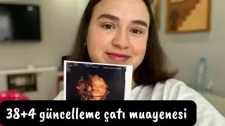 HAMİLEYİMMM🤰&Ccedil;atı Muayenesi,38+4 G&uuml;ncelleme🥰