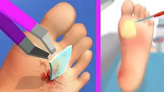 Foot Clinic 🦶🔍 Trailer Part - 001 All levels Clashes (iOS,Android) New game