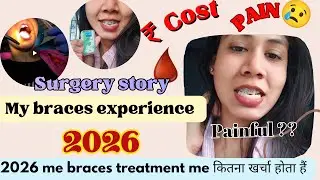 Braces treatment क्यों जरूरी हैं??? 2026 braces reality 😳 😱!!Real Braces Experience