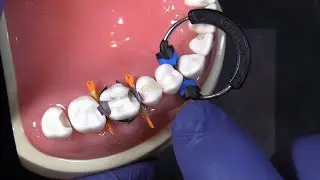 The Composi-Tight Soft Face 3D XR Ring from Garrison