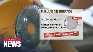 Blurred vision, age-related eye problems require regular check-ups