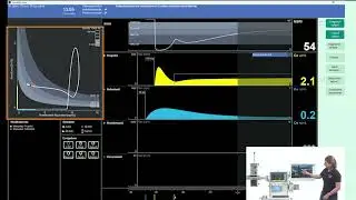 SmartPilot View Training &ndash; 2D-Digramm & Isobole