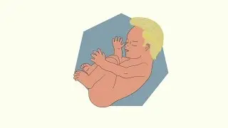 Trump&rsquo;s Proposed Punishments for Abortion Doctors
