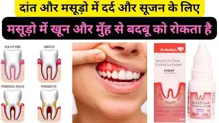 Stolin gum paint | मुँह में और मसूड़े में सूजन और दर्द के लिए |​⁠@MediReview