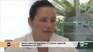 M&eacute;dica Dermatologista Solange Emanuelle Volpato Steckert fala sobre Hansen&iacute;ase ao SBT Meio Dia