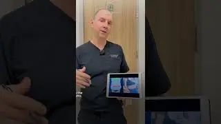 High BMI Tummy Tuck Case by Dr. Labarbera