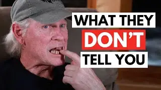 3 Reasons Why I Avoided Dental Implants