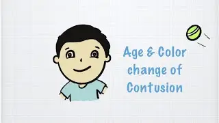 Age & Color change of Contusion