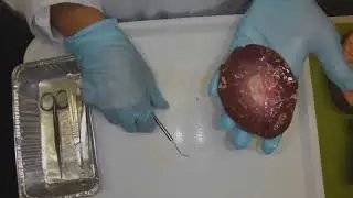 Dissection of a kidney