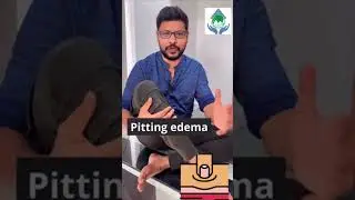 Foot swelling # one minute exercise # trending reels# youtubeshorts