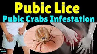 Pubic Lice Infestation (Pubic Crabs): Symptoms, Causes, Treatment, Complications & Prevention