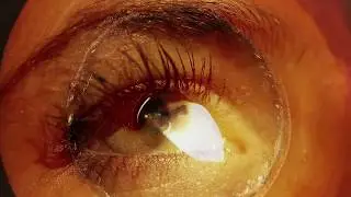 Angelo Bombay - All Good (Official Video)