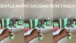 GENTLE MAGIC CAUSING SKIN TAGS..???