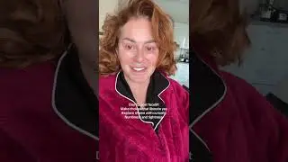 Deep plane face and neck lift at 55 - 25 days post surgery