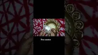 Meesho Urli Unboxing/ Diwali decoration Item #shorts