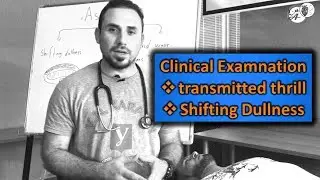 Clinical Examination: Ascites transmitted thrill Shifting Dullness I الفحص السريري للاستسقاء