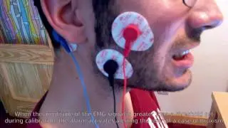 Bruxism alarm using EMG