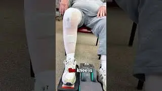 Cubii 48 hours after knee surgery