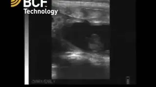 Easi Scan bovine 60 day fetus