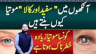 Difference Between Safed Motia & Kala Motia - Safed Motia Ki alamat - kala Motia Ki alamat