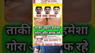 No Scars Cream Review | how to use no scars cream #skincare #shorts