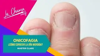 #ONICOFAGIA - ¿Cómo esculpir uñas mordidas o comidas? │ Master Class by La Chama Nails
