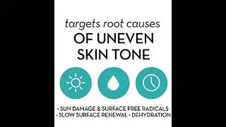Olay Professional Pro-X Even Skin Tone Spot Fading Treatment, 1.3 oz