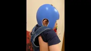 Cranial Orthosis for Babies|Cranial Orthotics| Helmet Therapy