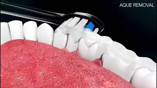 🦷Huacocare 2-in-1 Oral Care Set! Water Flosser + Electric Toothbrush, 5 Modes for Gum Care ✨