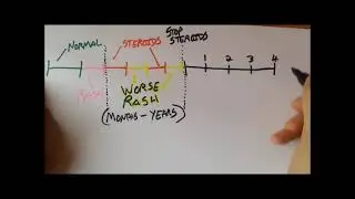 My Understanding Of Topical Steroid Addiction