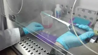 plasma separation from blood part 2